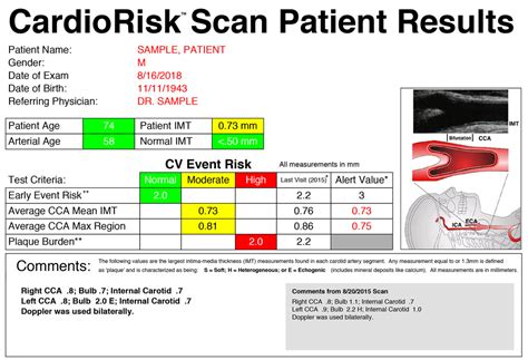 plaque scan carotid intima-media thickness testing or cimt|carotid intima media thickening.